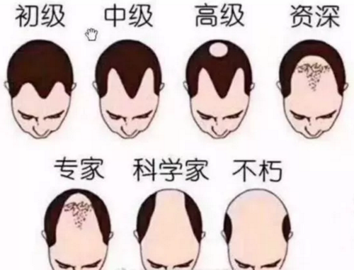 財會人掉發(fā)危機(jī)